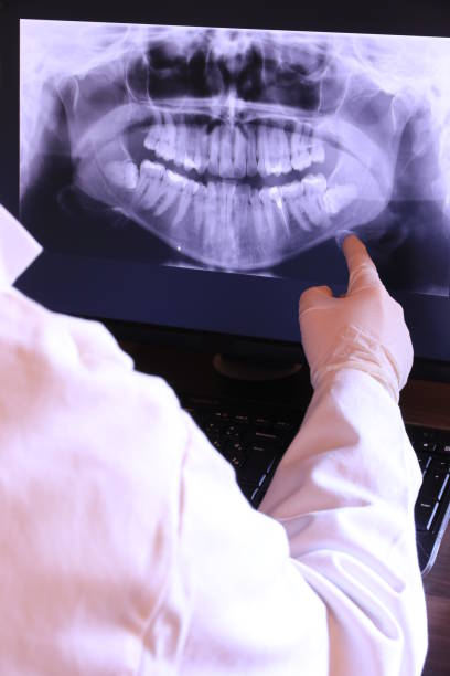 Best Broken or Chipped Tooth Repair in Three Rivers, CA